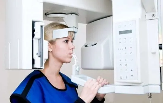 implantes