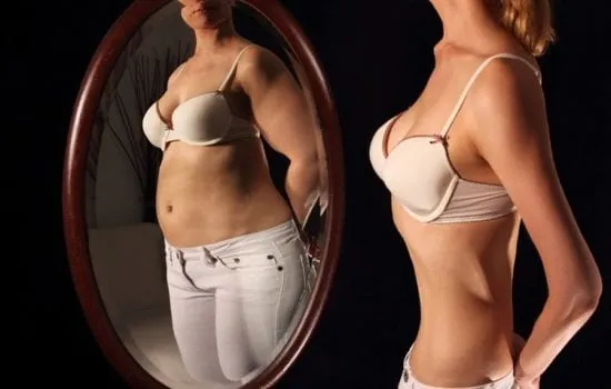 anorexia