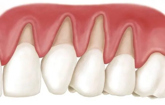 sensibilidade dentinária