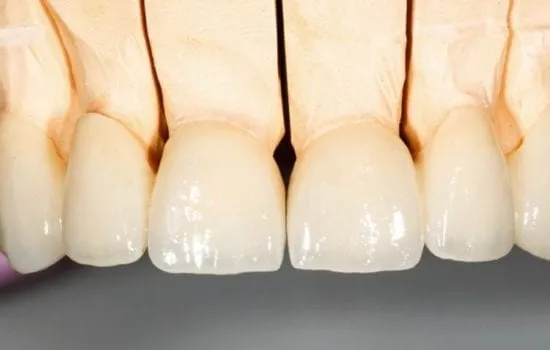 dentes