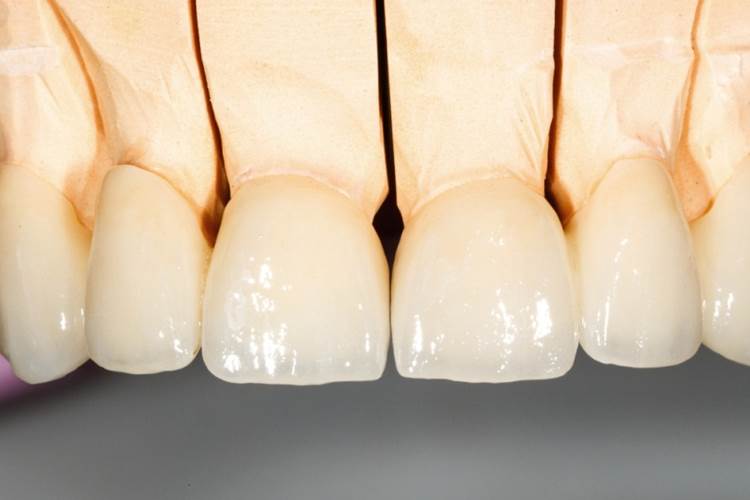dentes