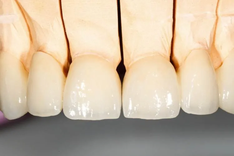 dentes