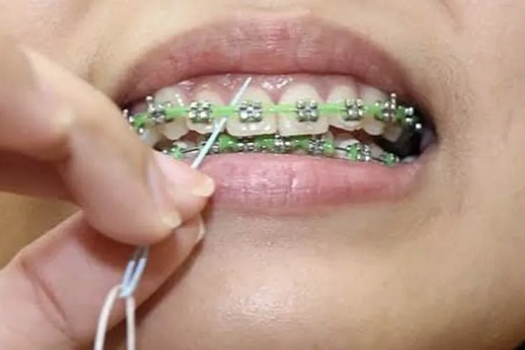 Luiz Pedro: A agulha passa fio dental